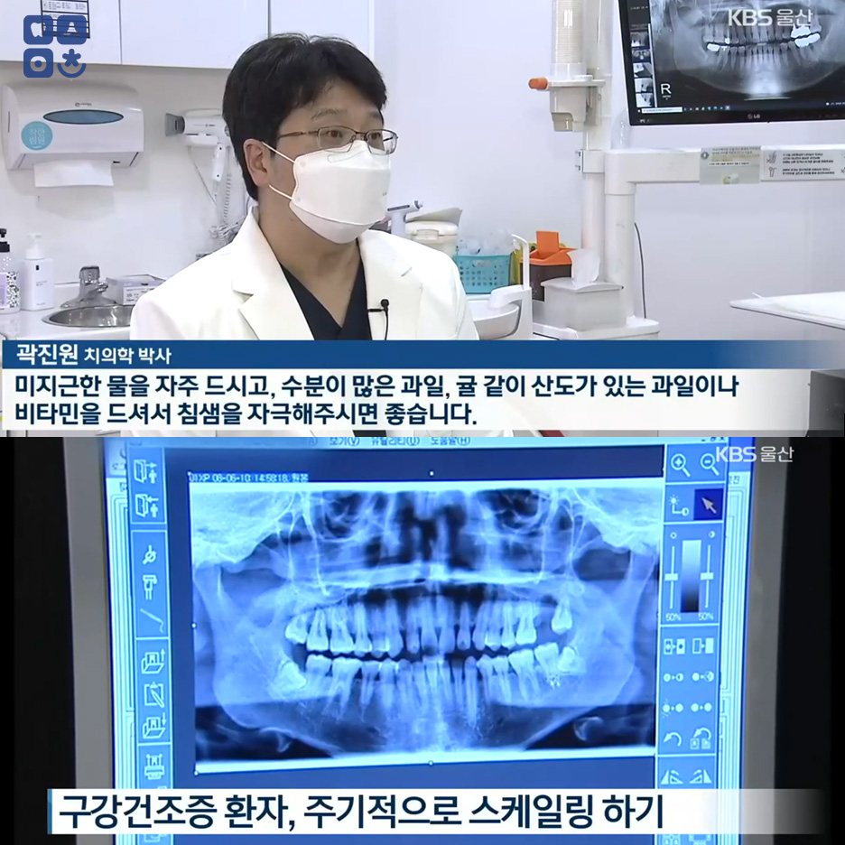 [뉴스] kbs 뉴스9 날씨와 생활 구강건조증 인터부
